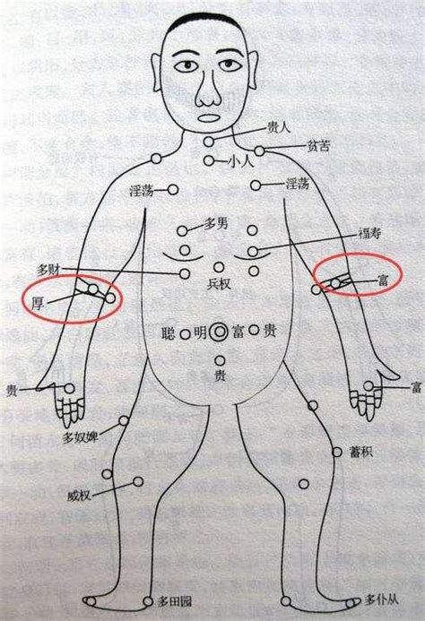 腰長痣